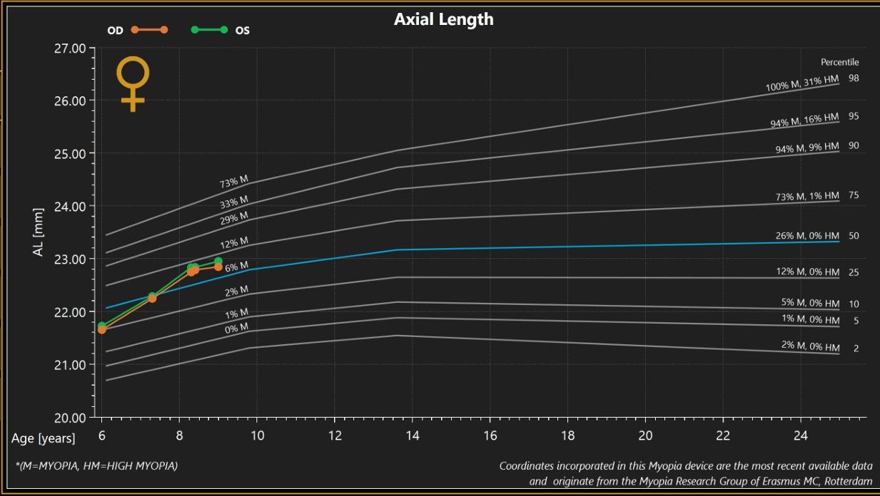 Graph showing axial length growth in a female child over time, with percentile curves for myopia progression and risk of high myopia.